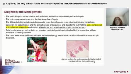 Arguably, the only clinical status of cardiac tamponade that pericardiocentesis is contraindicated.