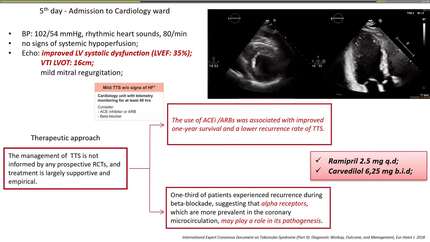 Pathophysiology-driven management of cardiogenic shock in Takotsubo syndrome