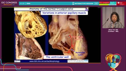 Presentation thumbnail