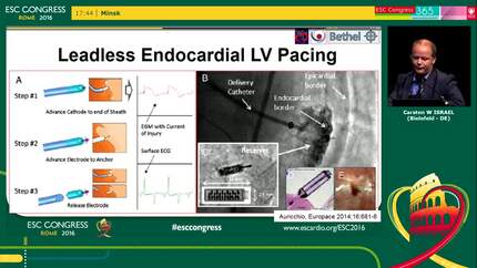 Presentation thumbnail