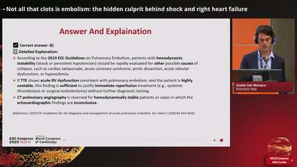 Pulmonary embolism with a twist: multisystem clues and unusual underlying causes 