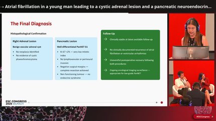Arrhythmias in systemic and structural disease