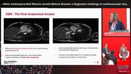 Cases of cardiac vasculitis