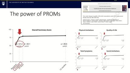 From bench to bedside: how to facilitate implementation of evidence-based practices in cardiovascular care 