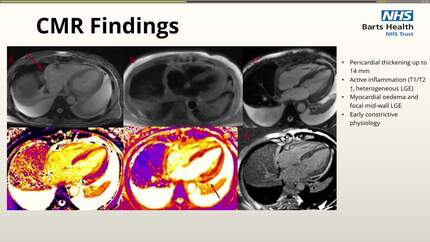 Presentation thumbnail