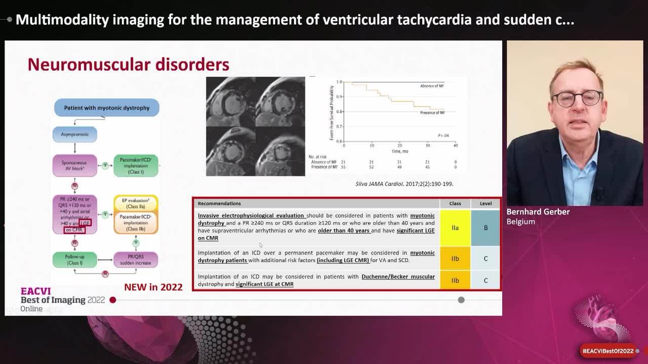 Multimodality imaging for the management of ventricular tachycardia and sudden cardiac death.