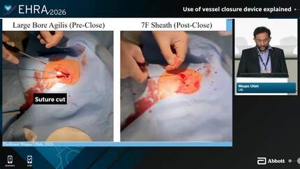 Presentation thumbnail