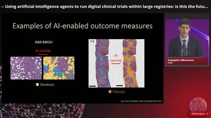 From concept to practice: utilising artificial intelligence to design the next generation of smart clinical trials