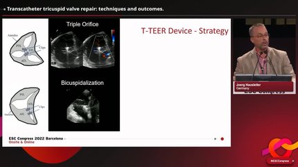 Presentation thumbnail