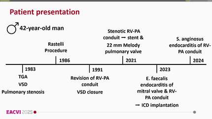 Diagnostic challenges in endocarditis