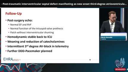 Post-traumatic interventricular septal defect manifesting as new onset third-degree atrioventricular block
