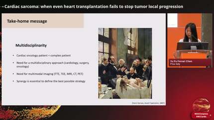 Cardiac sarcoma: when even heart transplantation fails to stop tumor local progression