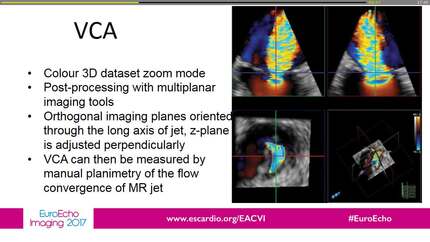 Diagnostic value of echocardiographic 3D quantification methods in mitral regurgitation: comparison with 2D standard quantification methods 