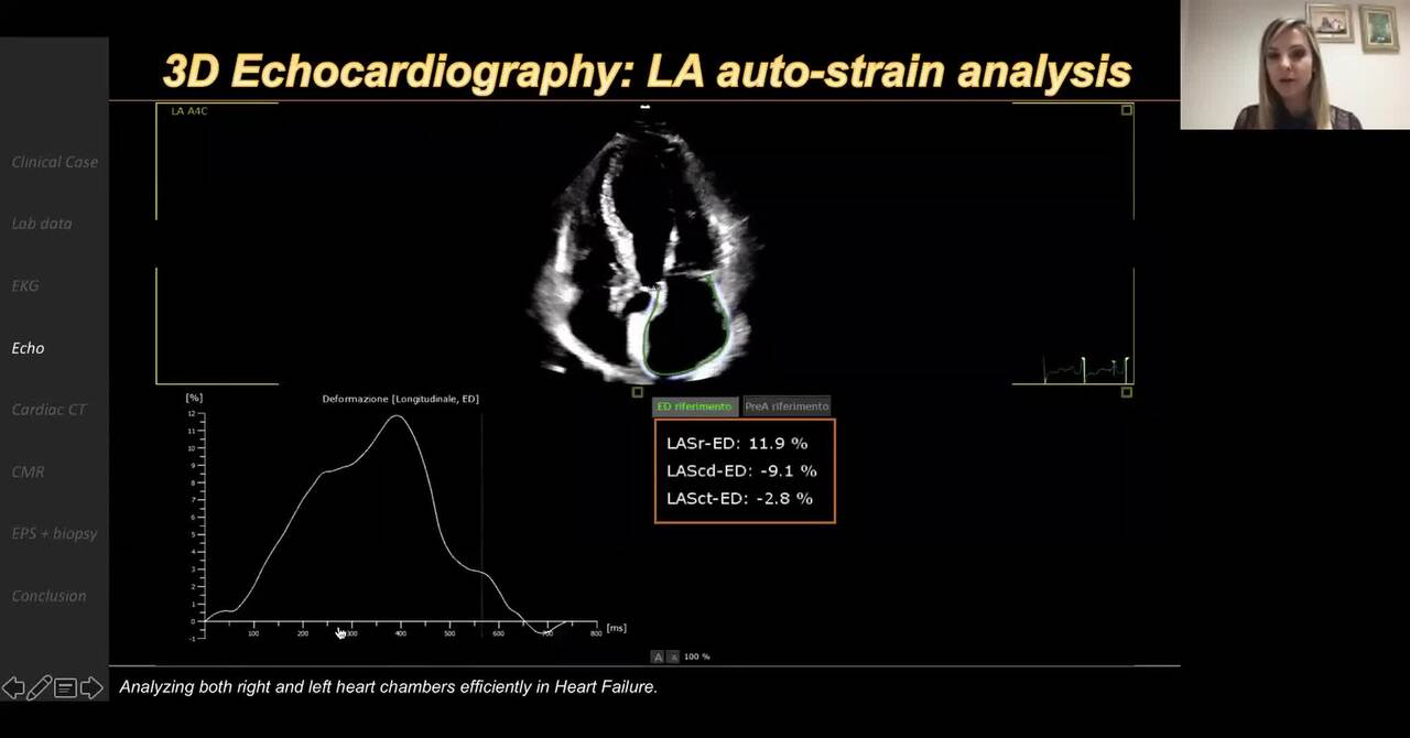 Analyzing both right and left heart chambers efficiently in Heart Failure.