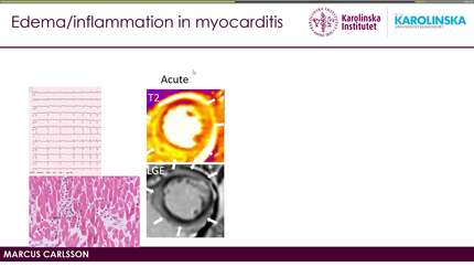 Presentation thumbnail
