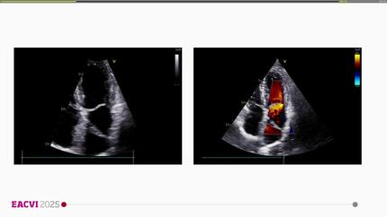 Presentation thumbnail