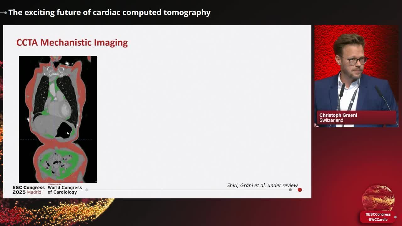 The exciting future of cardiac computed tomography