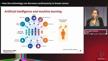 How the technology can decrease cardiotoxicity in breast cancer