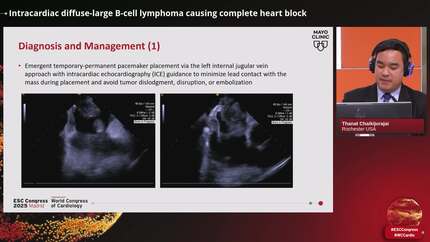 Presentation thumbnail