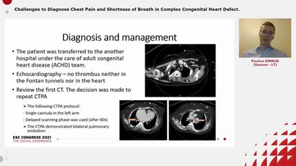 Challenges to Diagnose Chest Pain and Shortness of Breath in Complex Congenital Heart Defect.