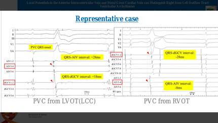 Presentation thumbnail