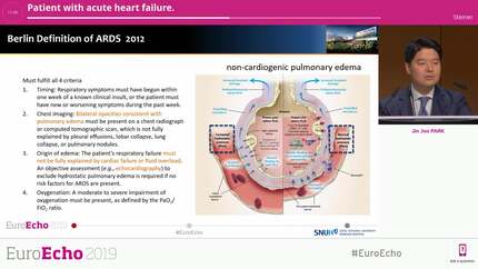 Patient with acute heart failure.