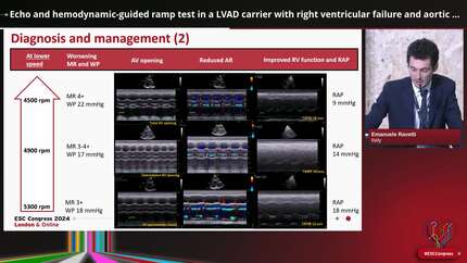 Echo and hemodynamic-guided ramp test in a LVAD carrier with right ventricular failure and aortic regurgitation: unveiling the Scylla and Charybdis of durable mechanical circulatory support