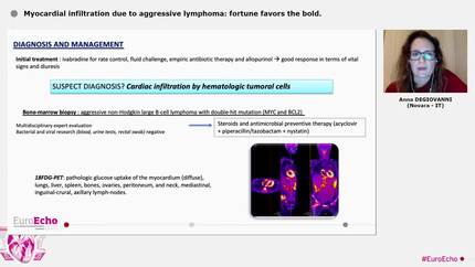 Myocardial infiltration due to aggressive lymphoma: fortune favors the bold.