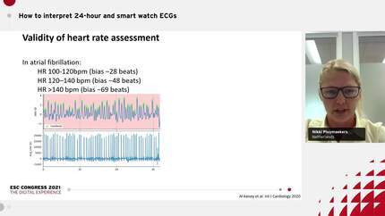 ECG challenges from smartwatch recordings.