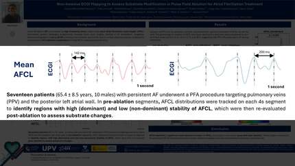 Non-invasive assessment of substrate modification during atrial fibrillation ablation with pulse field ablation using imageless ECGI