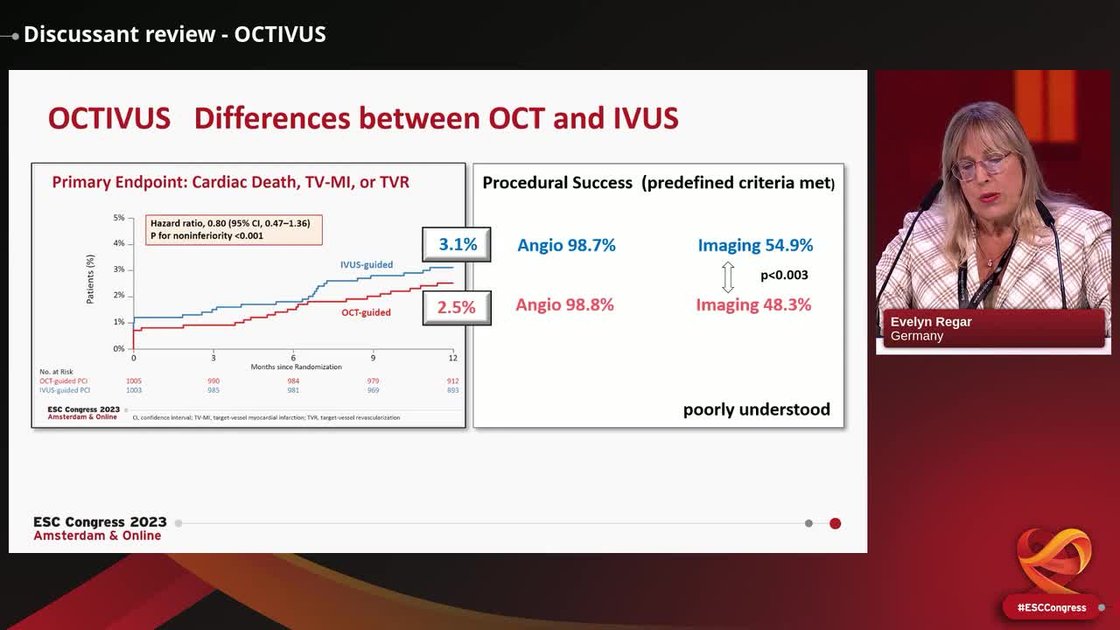 ESC 365 - Discussant review - OCTIVUS