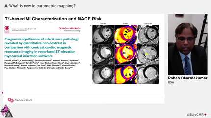 What is new in parametric mapping?