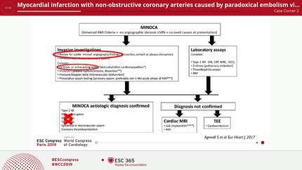 Myocardial infarction with non-obstructive coronary arteries caused by paradoxical embolism via patent foramen ovale: just another hole in the wall.