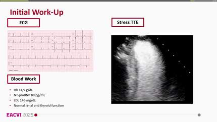 Between arteries, silent but possibly deadly: a case of an anomalous origin of a coronary artery 
