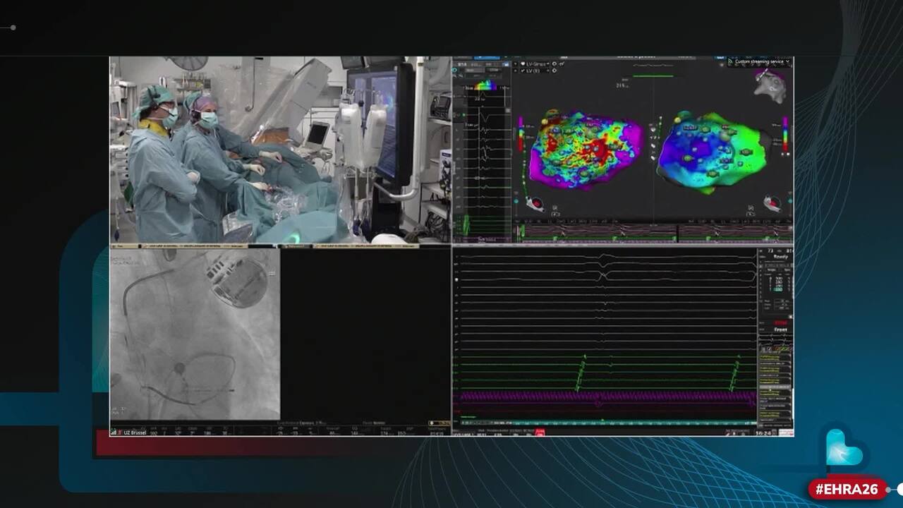 Live cases: cutting-edge pulsed field ablation! 