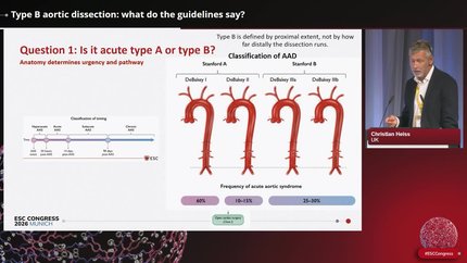 Guidelines in Practice: aortic dissection