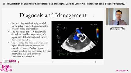 Visualization of Bivalvular Endocarditis and Transeptal Cardiac Defect Via Transesophageal Echocardiography.