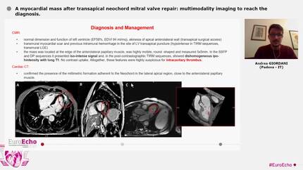 A myocardial mass after transapical neochord mitral valve repair: multimodality imaging to reach the diagnosis.