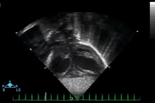 洋書 Echocardiography in Congenital Heart Dis Echocardiography in Pediatric and Congenital Heart Disease