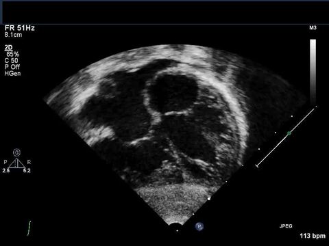 Echocardiography in Pediatric and Congenital Heart Disease 2e