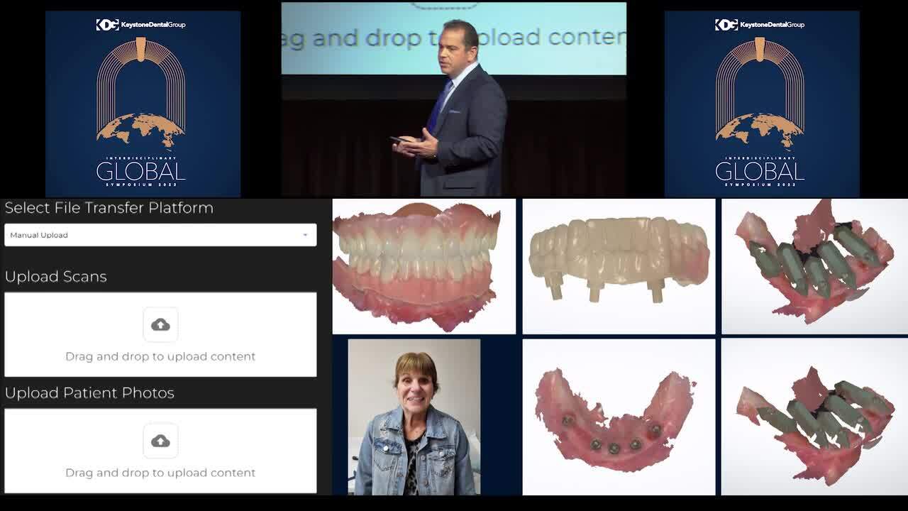 Keystone Dental Announces Market Launch of Nexus Connect, the First A.I.  Enabled Intraoral Implant-Scan Analyzer for the Nexus iOS Full-Arch  Solution