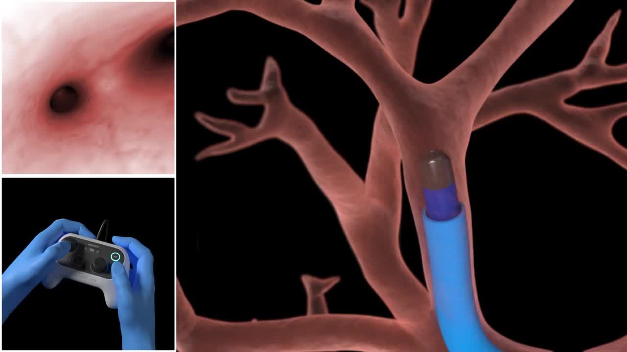 Fist Abc Physician Relations Medical Animations Gallery