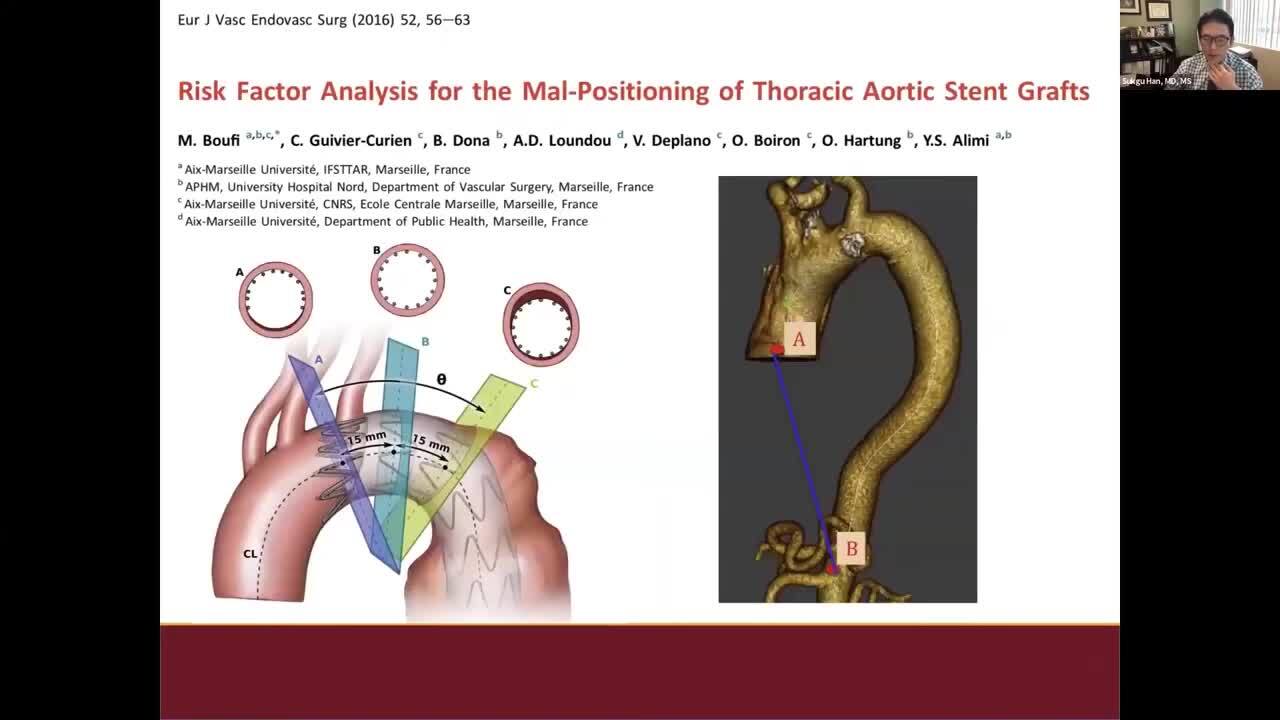Case Studies | TAG® Conformable Thoracic Stent Graft | Gore