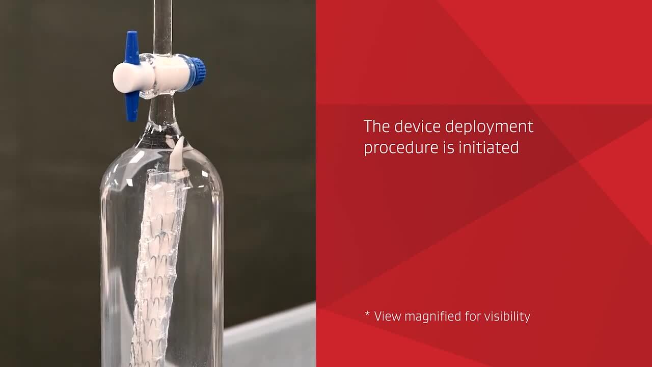 Minimizing Air During TEVAR | TAG® Conformable | Gore Medical