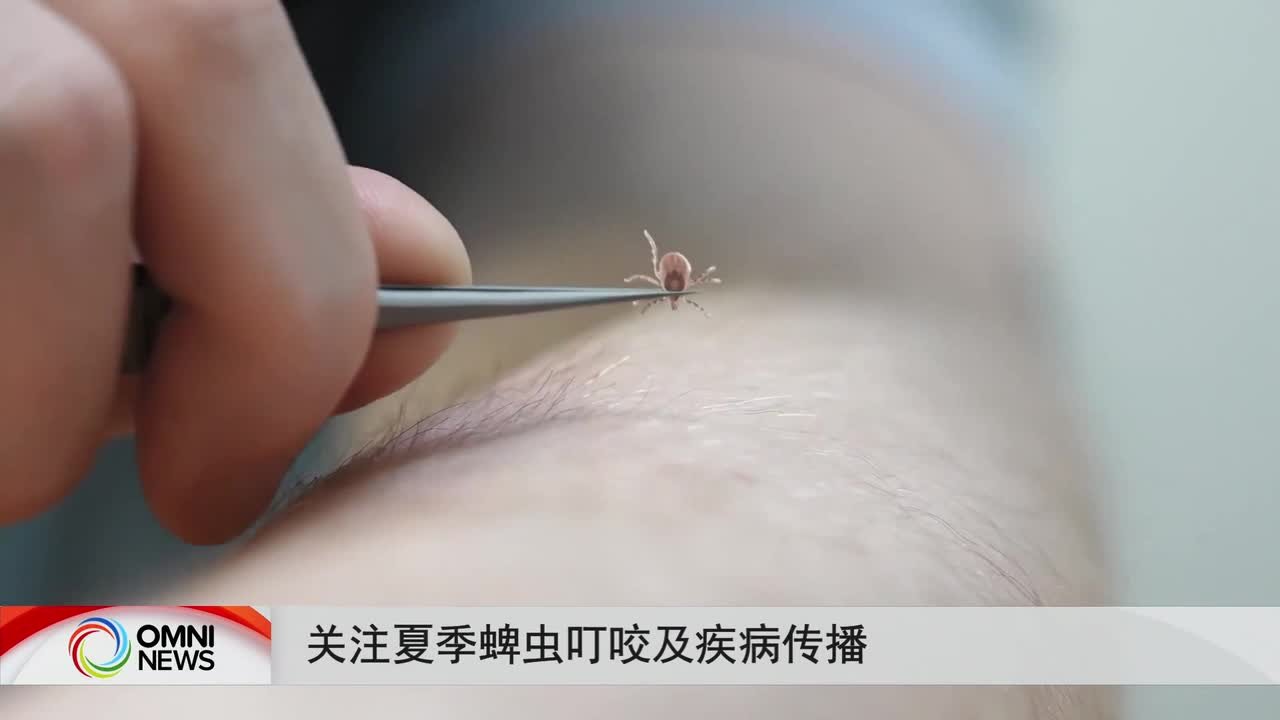 夏季如何防范蜱虫叮咬和相关疾病