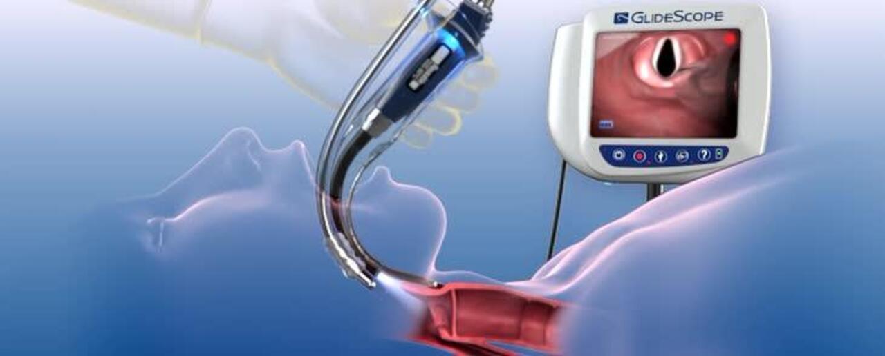 Video GlideScope® Video Laryngoscope