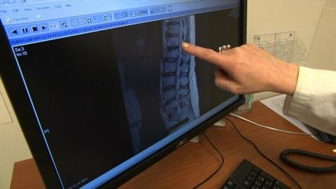 Imaging tests for lower-back pain
