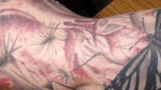 Safer tattoos
