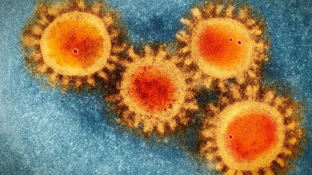 How to Protect Yourself From COVID-19