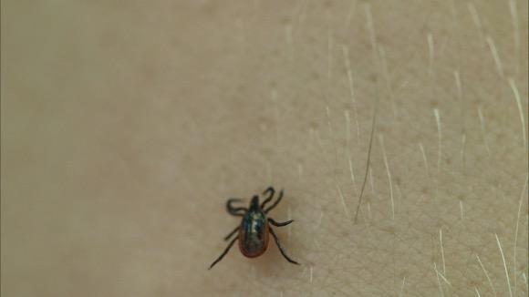 Don't Bother Using These Tick Removal Methods